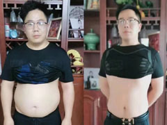 张海龙，牙科主?任?3个月成功减重44斤，减脂